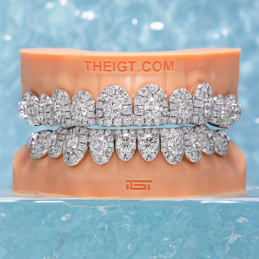 50 Pointer Stone On Center Moissanite Diamond Grillz