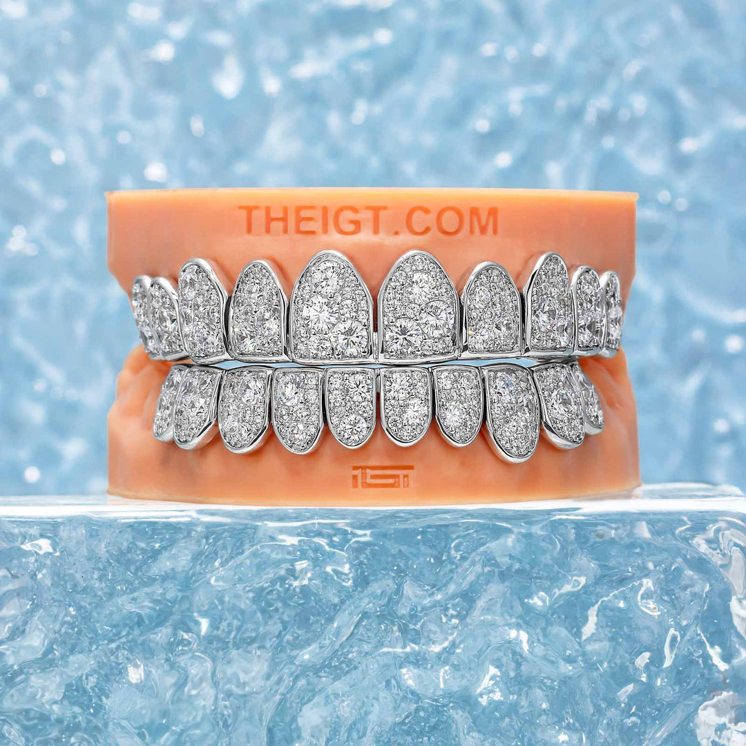 Mosaic/Snow Set Moissanite Diamond Grillz