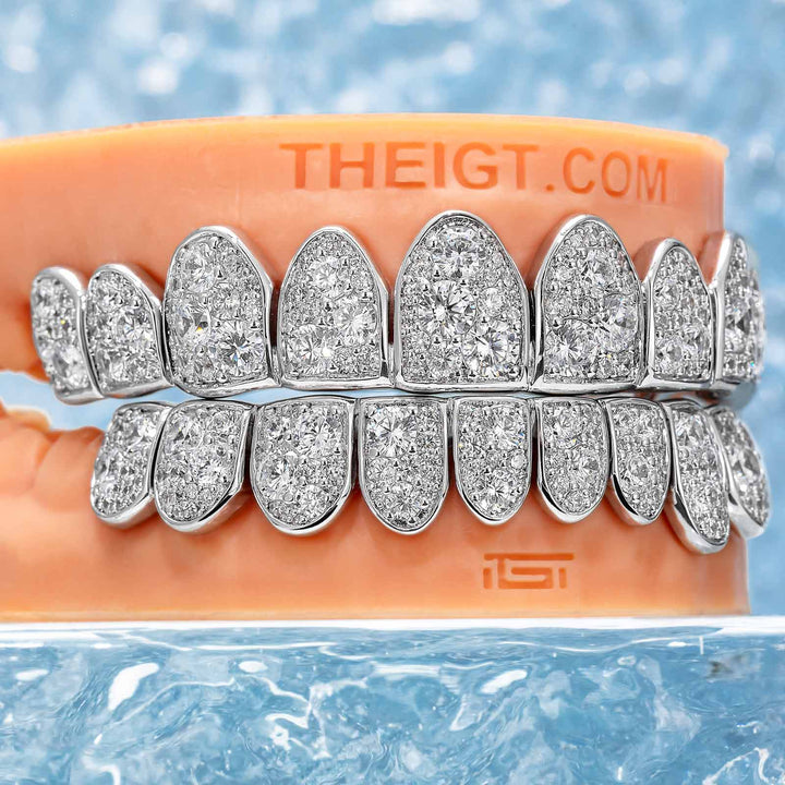 Mosaic/Snow Set Moissanite Diamond Grillz