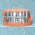 Custom Vampire Polished Gold Grillz