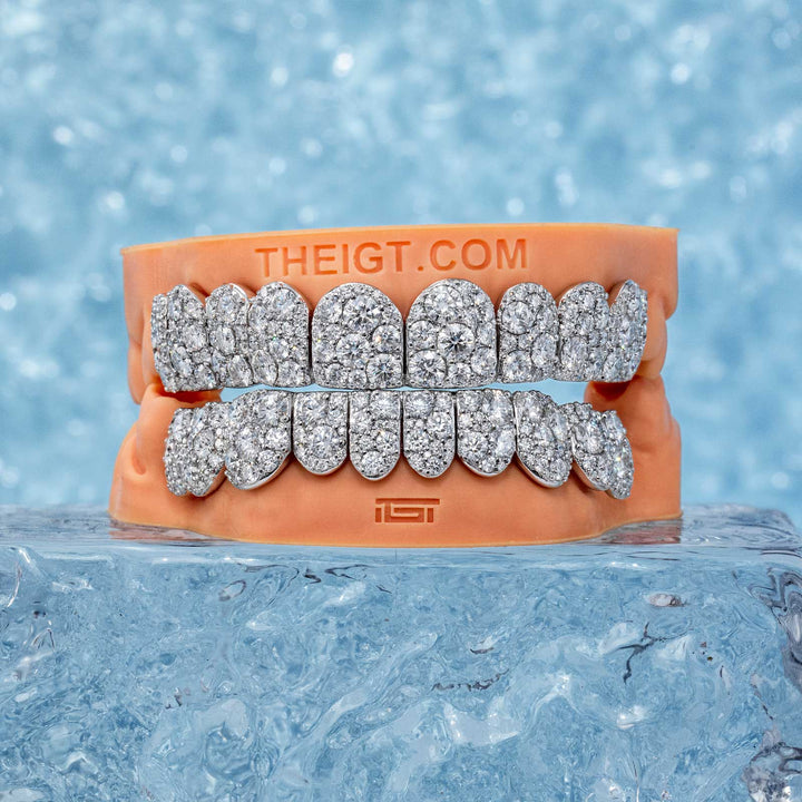 Mosaic/Snow Set Moissanite Diamond Grillz