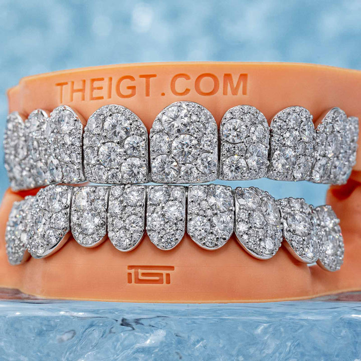 Mosaic/Snow Set Moissanite Diamond Grillz