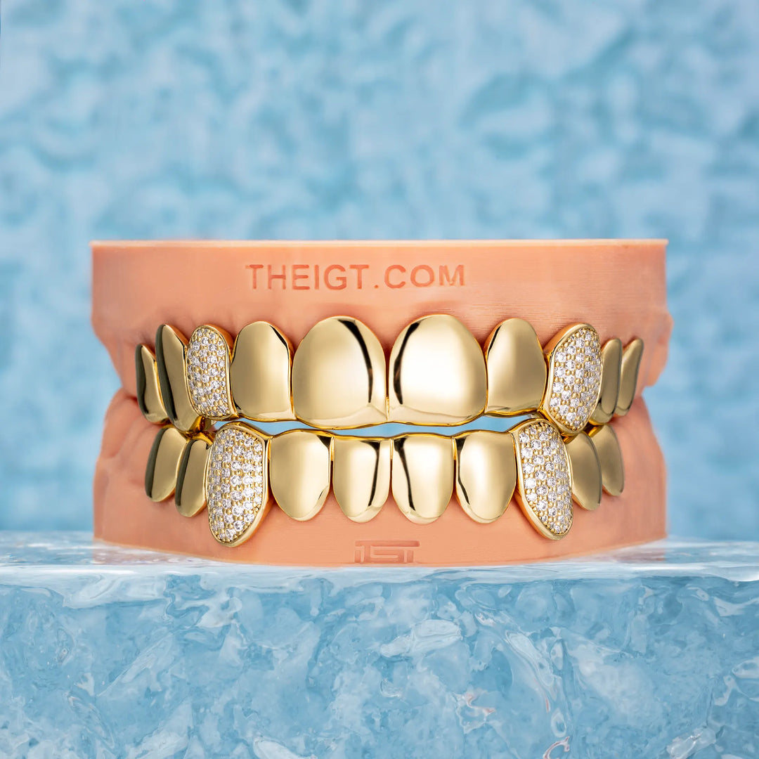 Custom Polished Gold & Diamond Grillz
