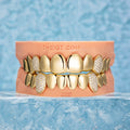 Custom Polished Gold & Diamond Grillz