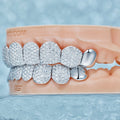 Custom End Capped Moissanite Grillz