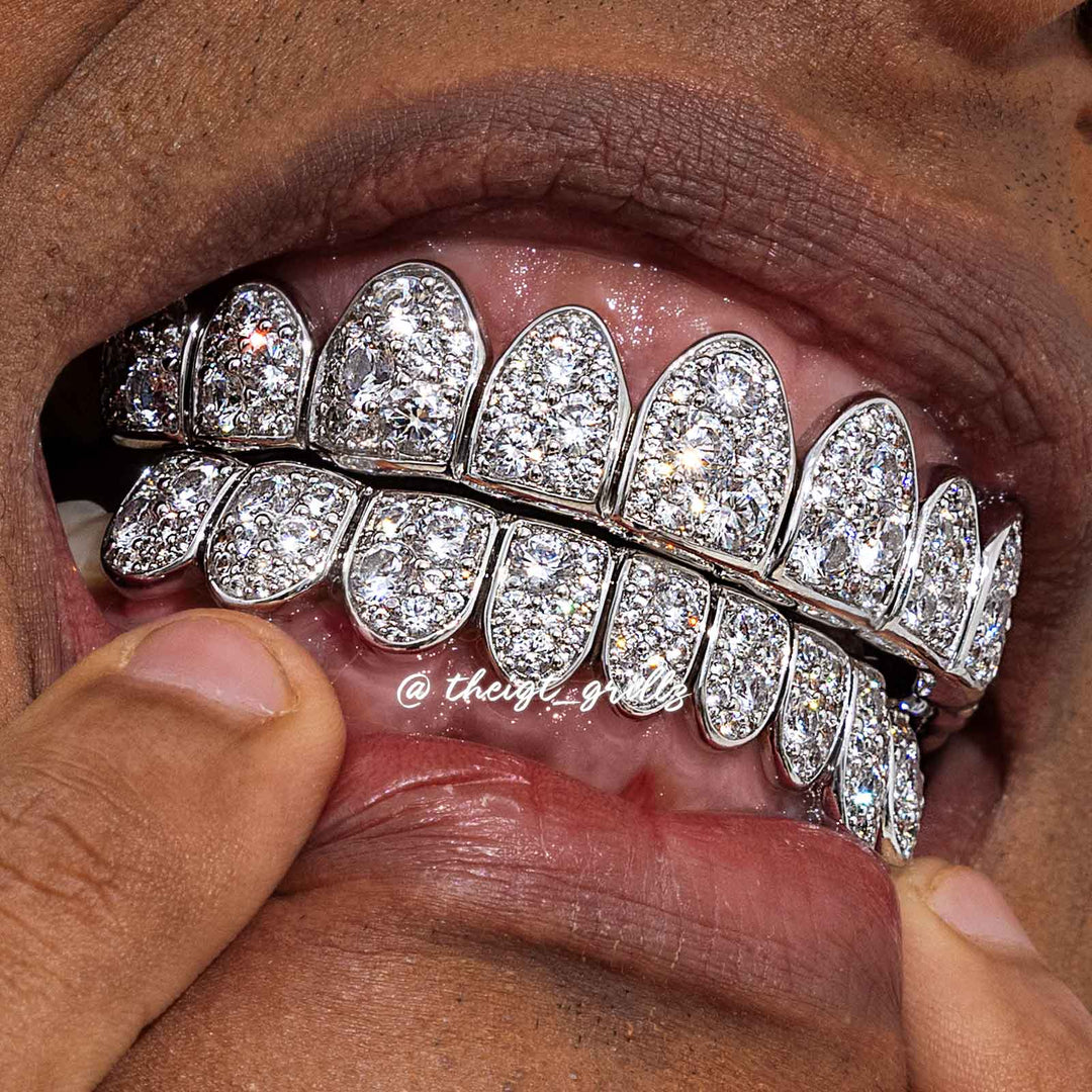 Mosaic/Snow Set Moissanite Diamond Grillz