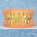 Custom Polished Gold Pattern Grillz