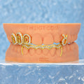 Custom Moissanite Zodiac Initials Bar Grillz