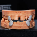 Iced Caps Grillz