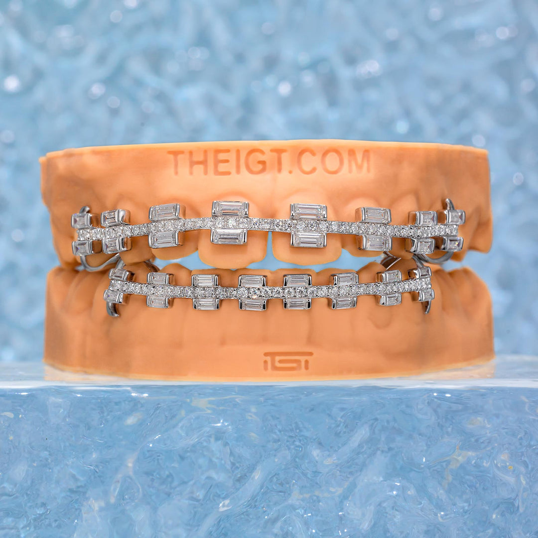 Rectangular Cut Brace Style Grillz