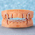 Top 4 Open Face With Bottom Wave Bar Grillz