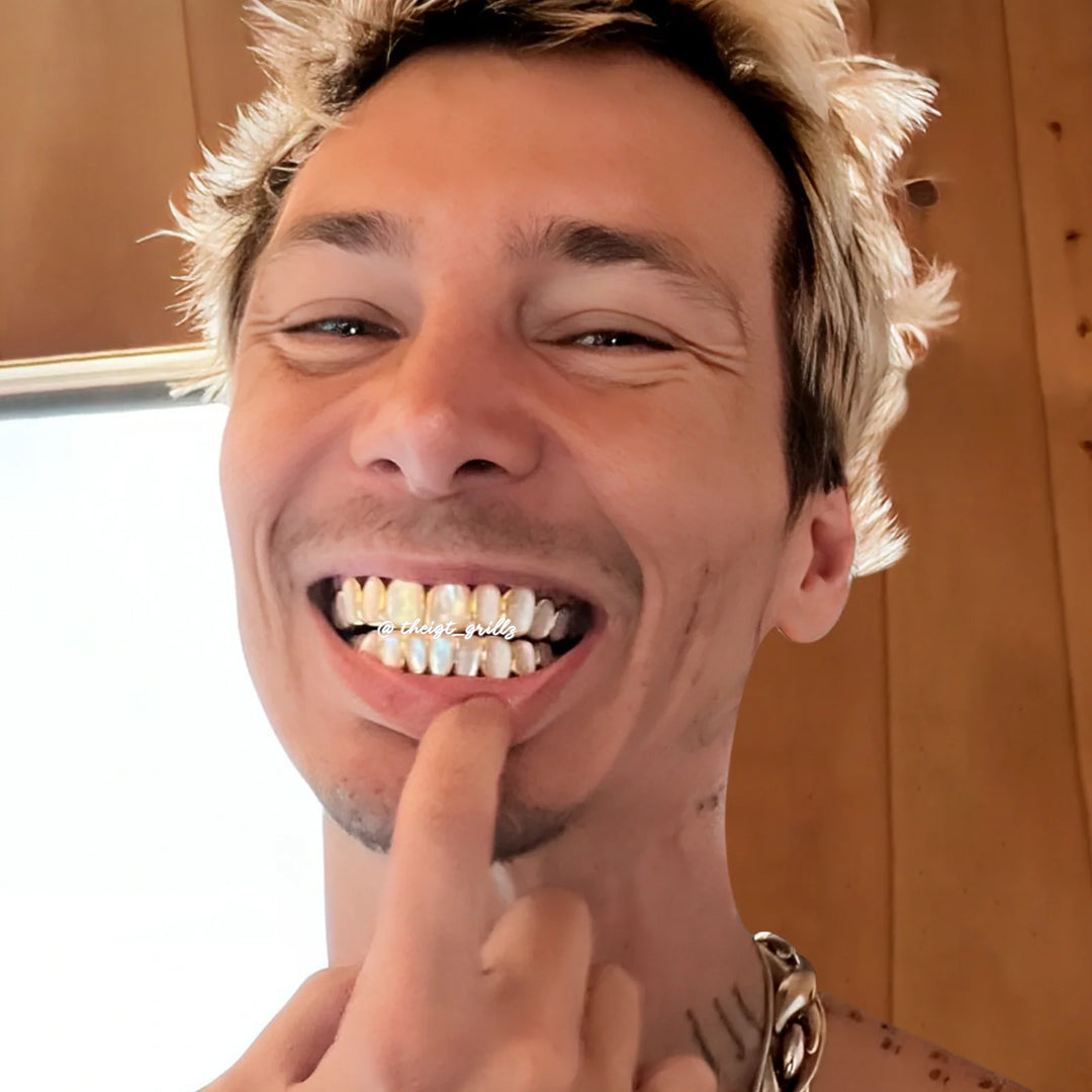 White Shell Grillz