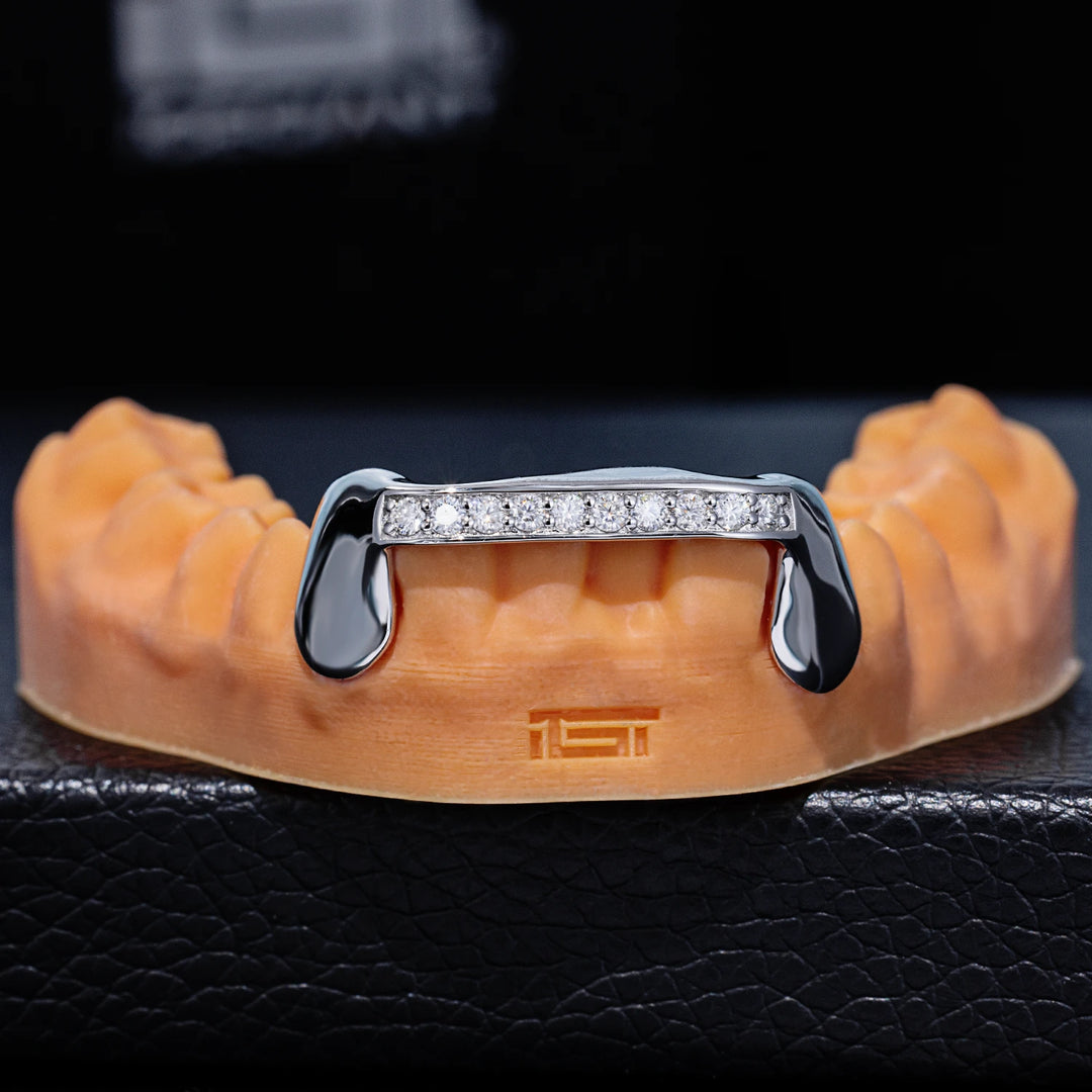Diamond Bridge Grillz w/ Solid Gold Fangs