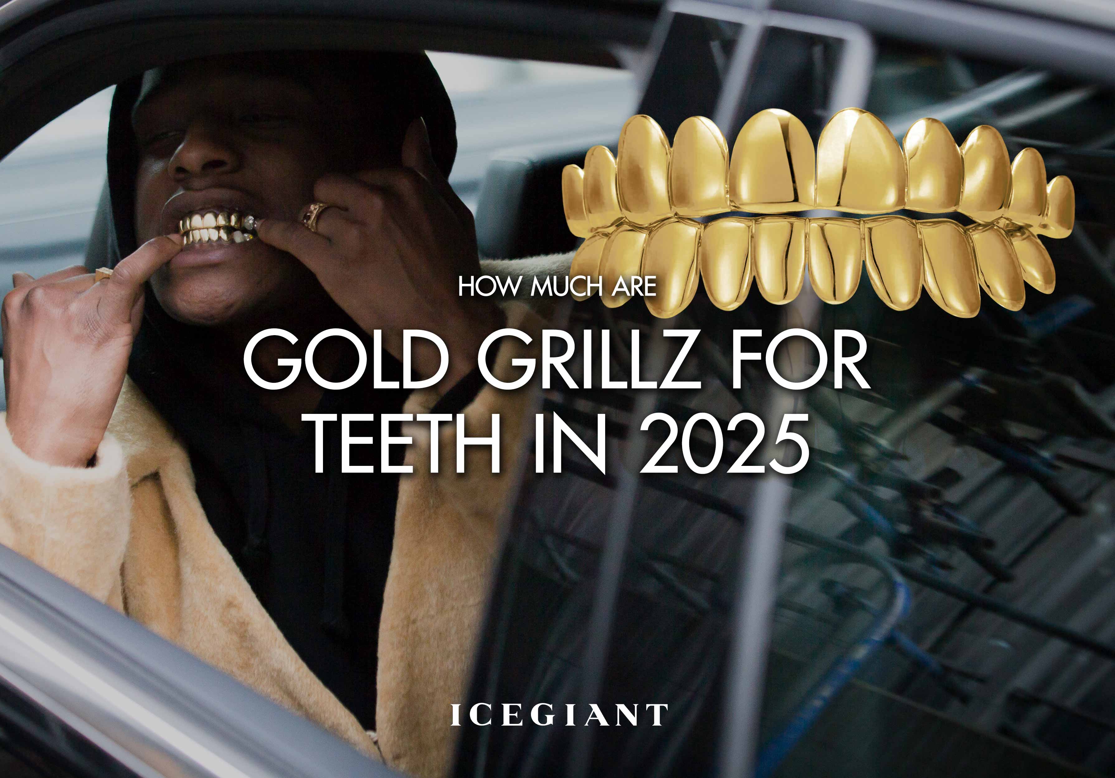 HOW MUCH ARE GOLD GRILLZ FOR TEETH IN 2025