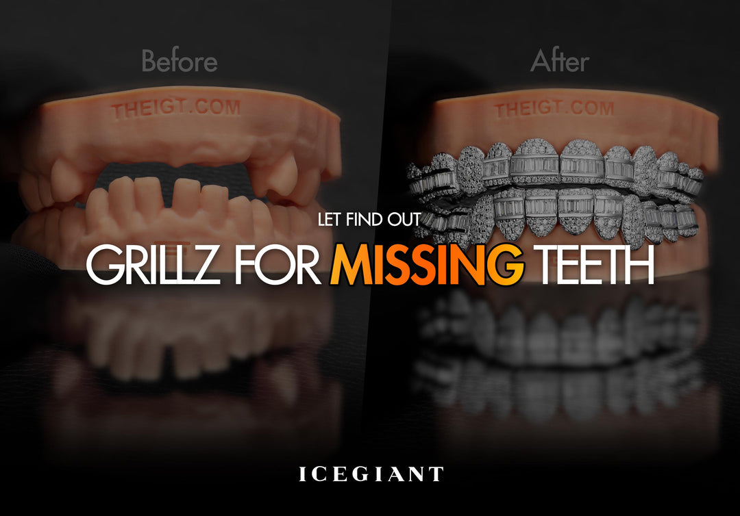 GRILLZ FOR MISSING TEETH