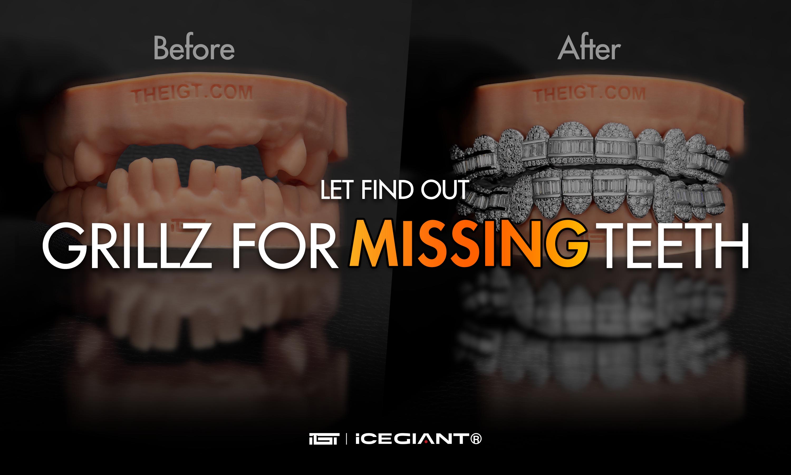GRILLZ FOR MISSING TEETH
