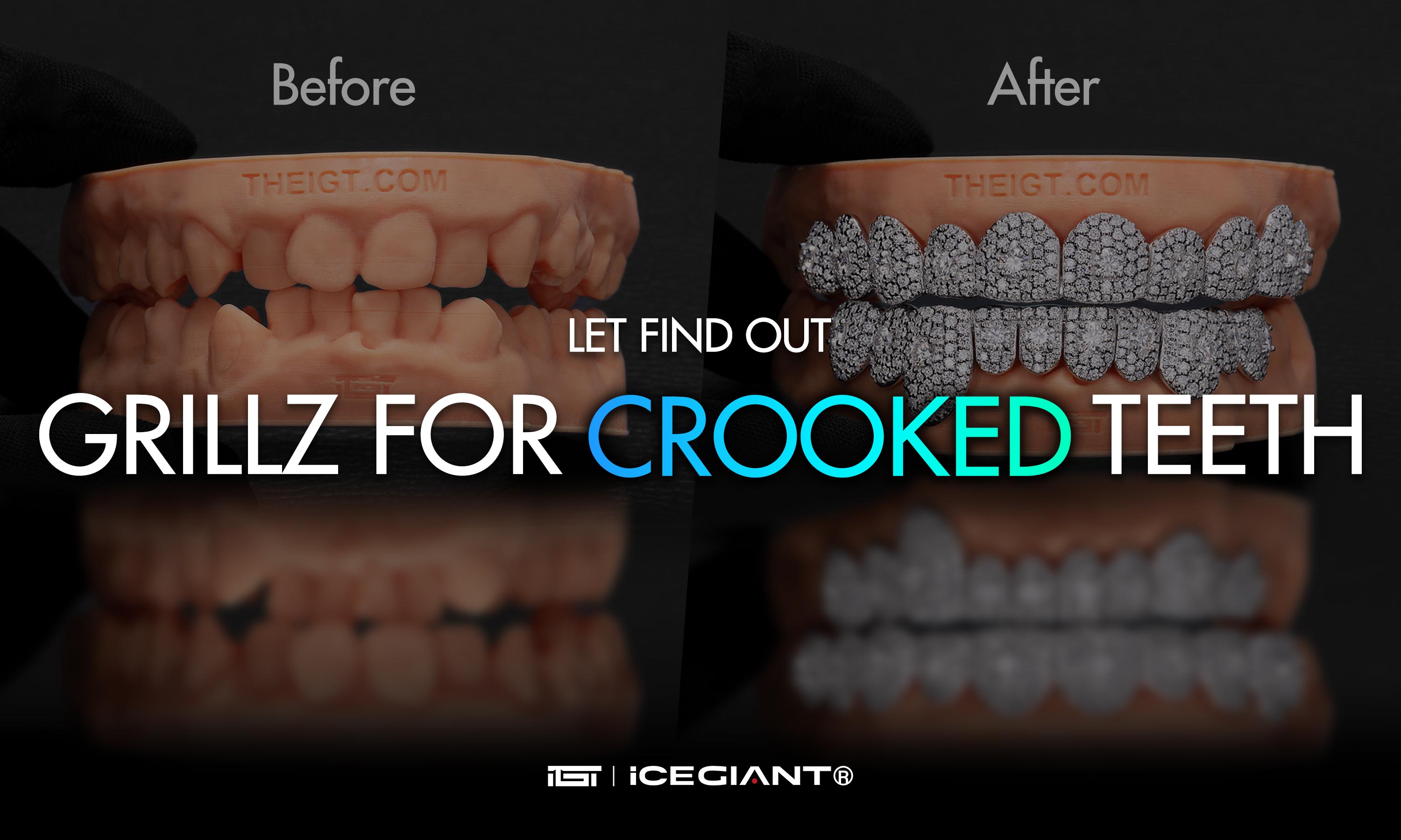 LET FIND OUT: GRILLZ FOR CROOKED TEETH?
