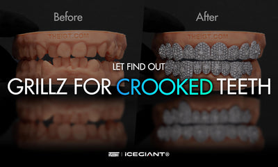 LET FIND OUT: GRILLZ FOR CROOKED TEETH?