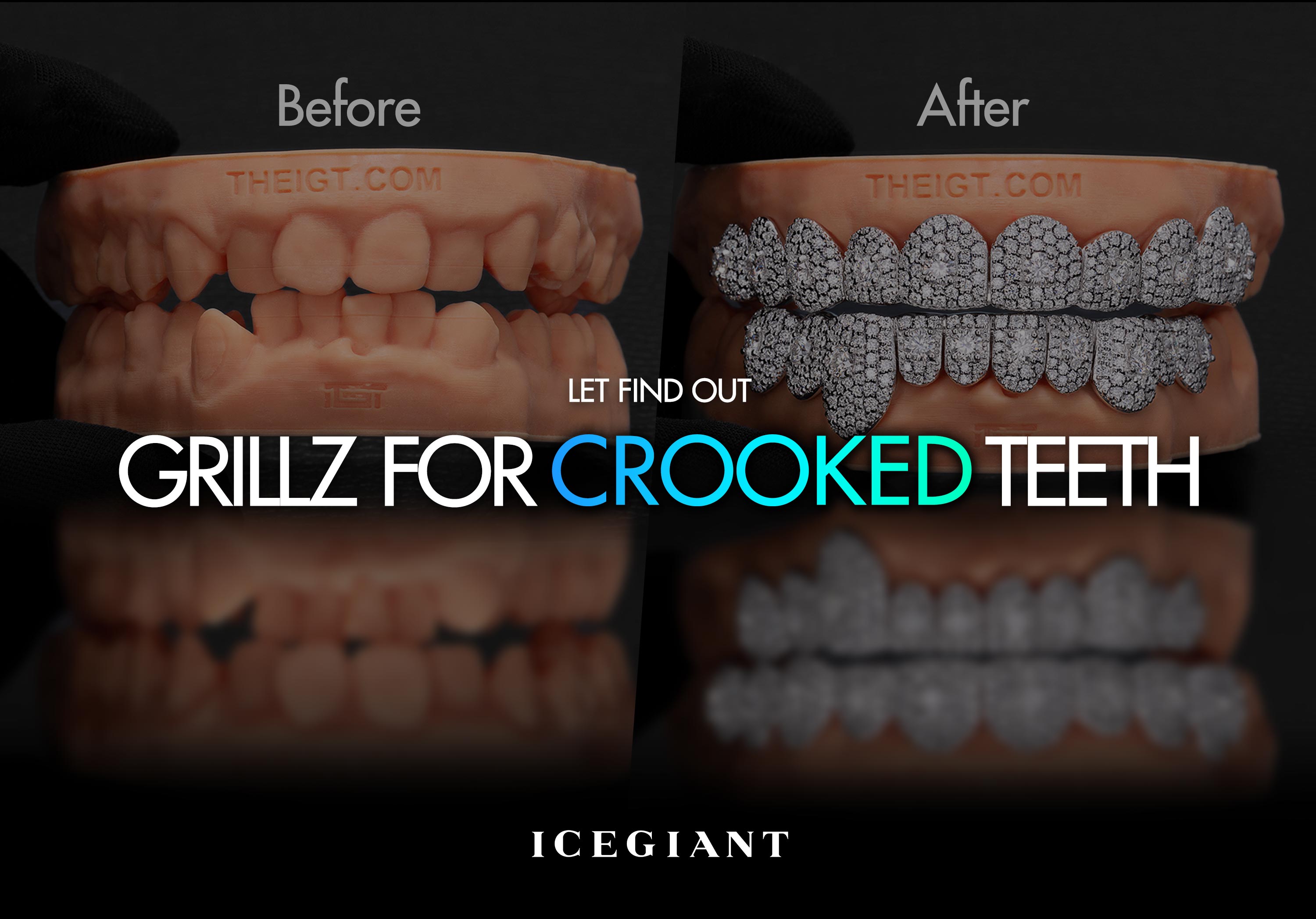 LET FIND OUT: GRILLZ FOR CROOKED TEETH?