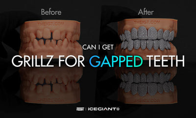 CAN I GET GRILLZ FOR GAPPED TEETH