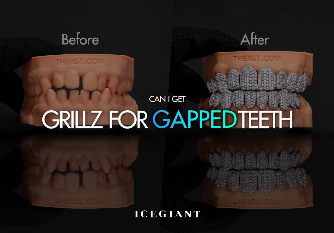 CAN I GET GRILLZ FOR GAPPED TEETH