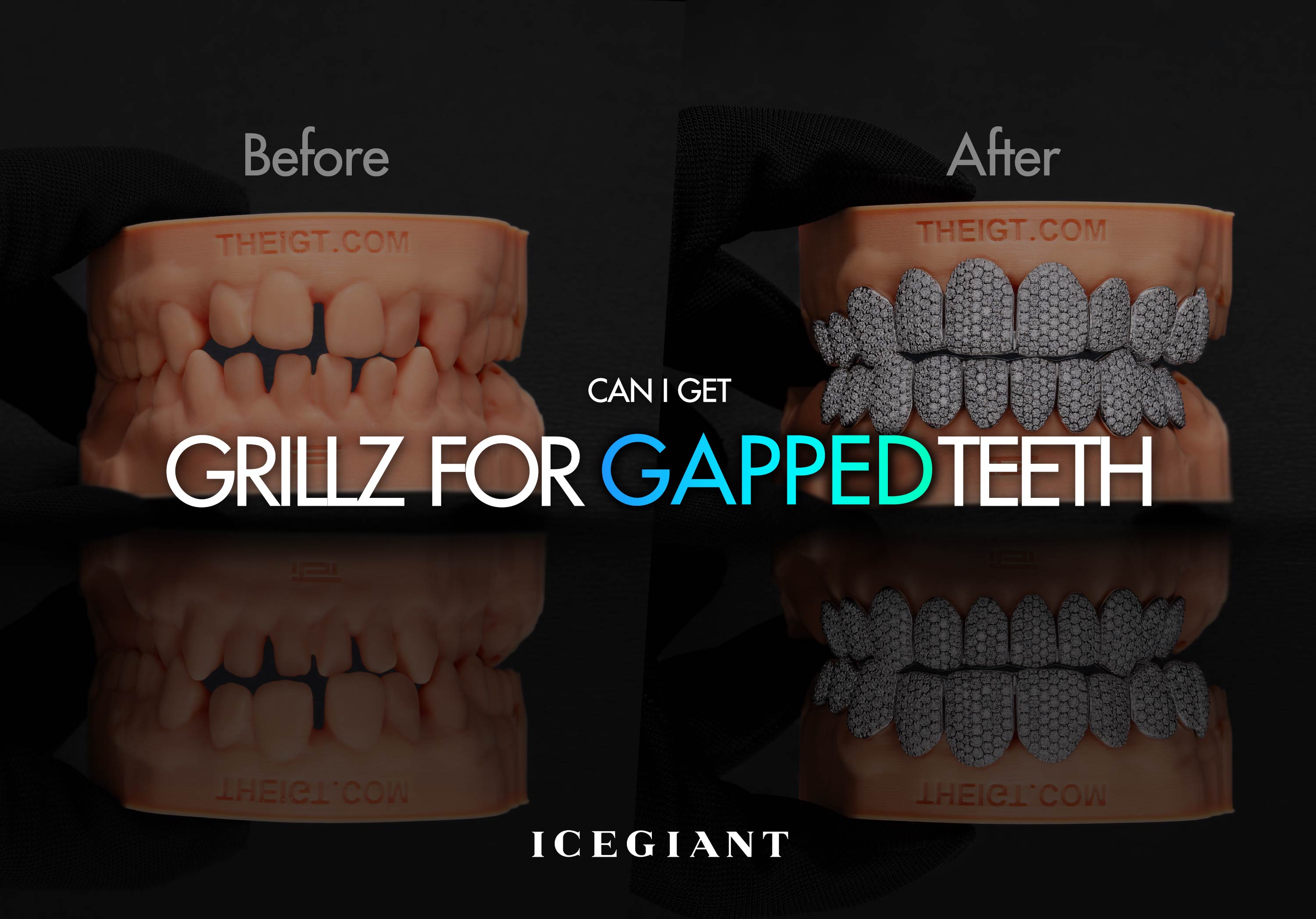 CAN I GET GRILLZ FOR GAPPED TEETH