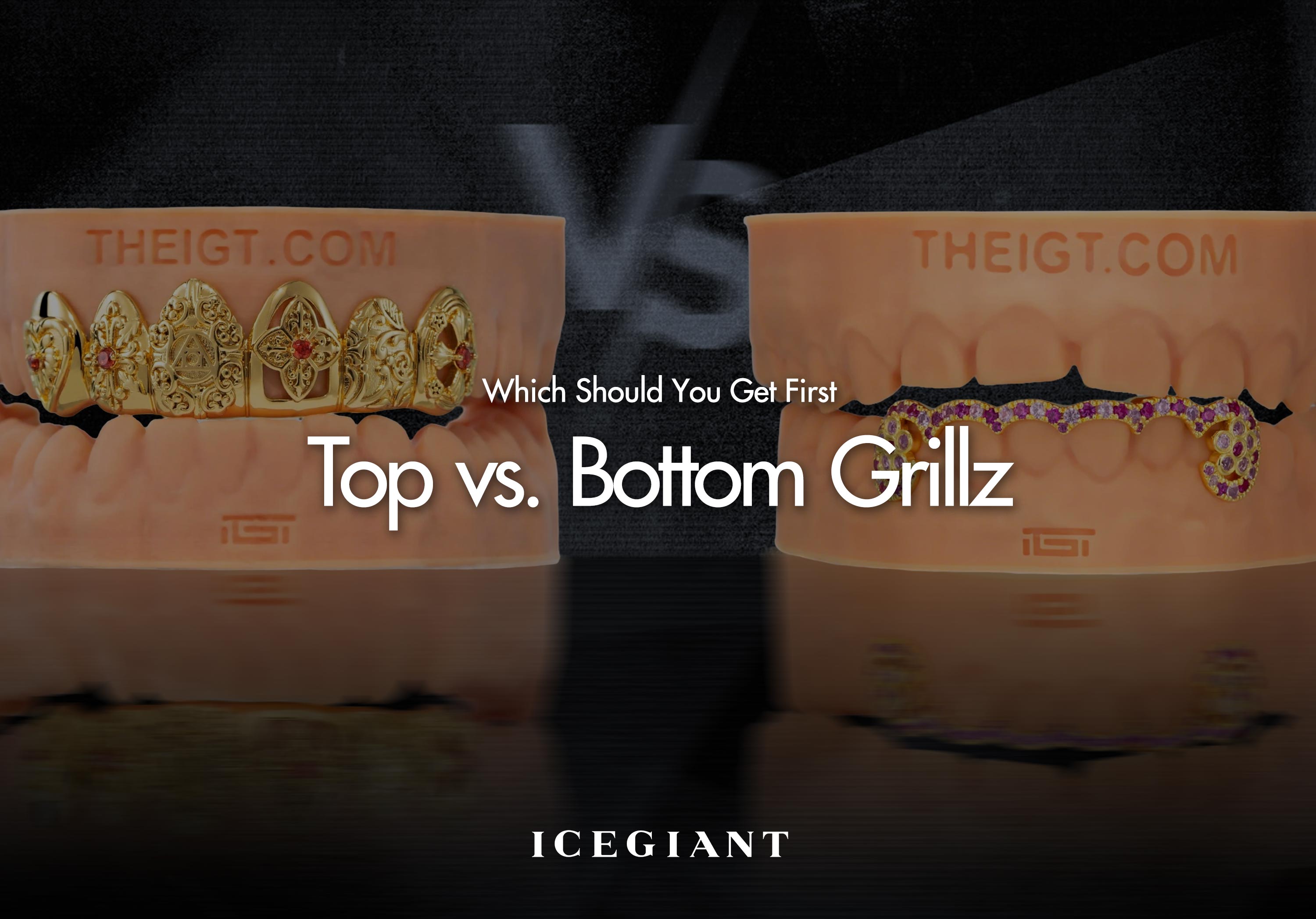 Top vs. Bottom Grillz: Which Should You Get First