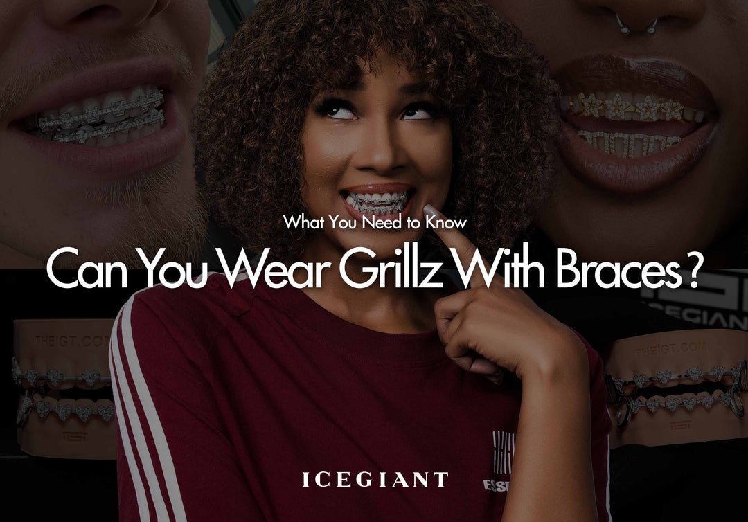Can You Wear Grillz With Braces? What You Need to Know