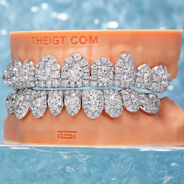 50 Pointer Stone On Center Moissanite Diamond Grillz