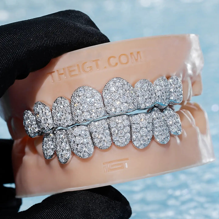 Custom Jumbo (6 Pointers) Moissanite Diamond Grillz