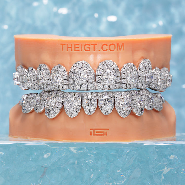 50 Pointer Stone On Center Moissanite Diamond Grillz
