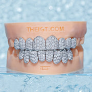 CUSTOM JUMBO (6 POINTERS) MOISSANITE DIAMOND GRILLZ