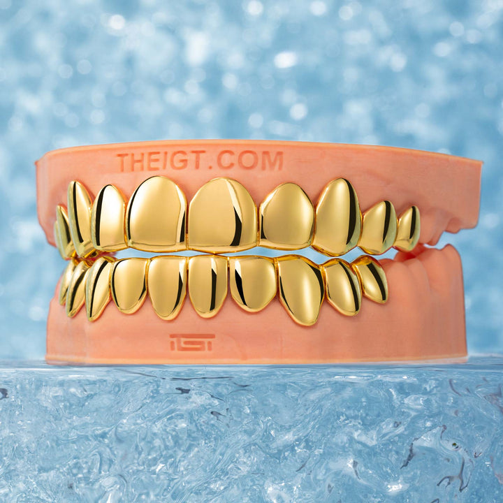 Custom Polished Gold Grillz