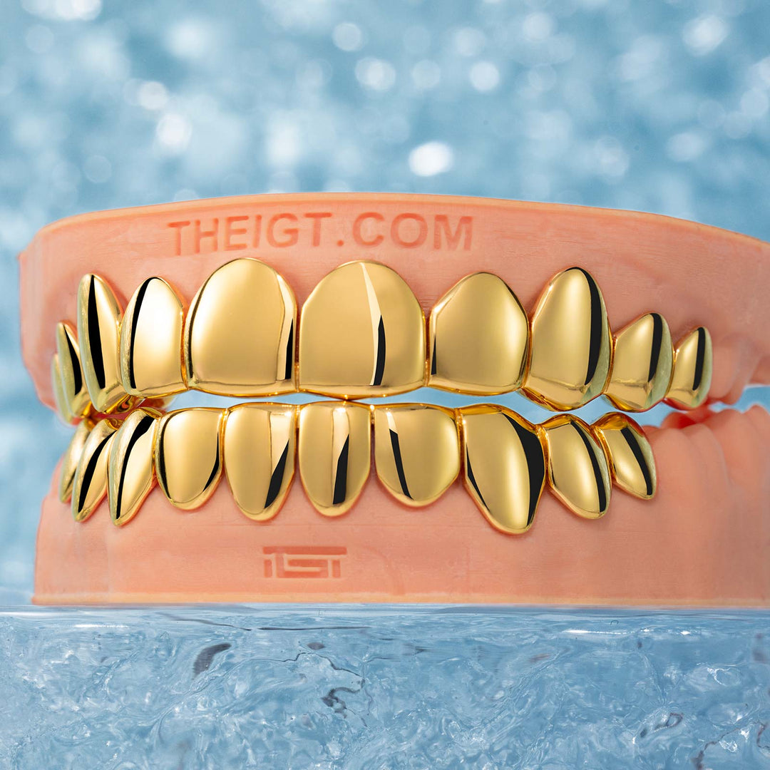 Custom Polished Gold Grillz