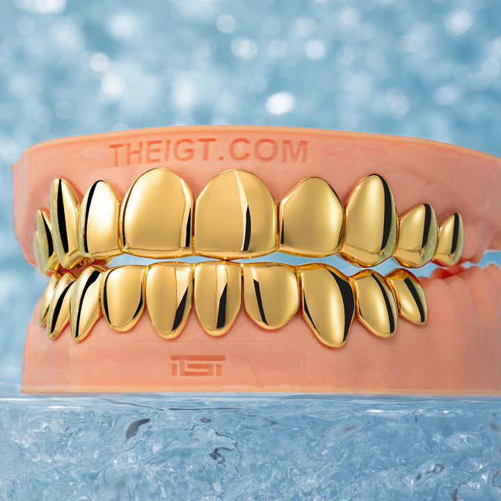 Custom Polished Gold Grillz