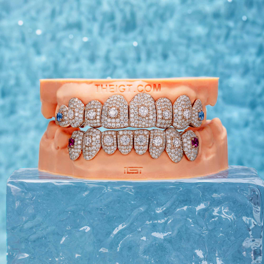 16 Pointer Stone On Center Moissanite Diamond Grillz