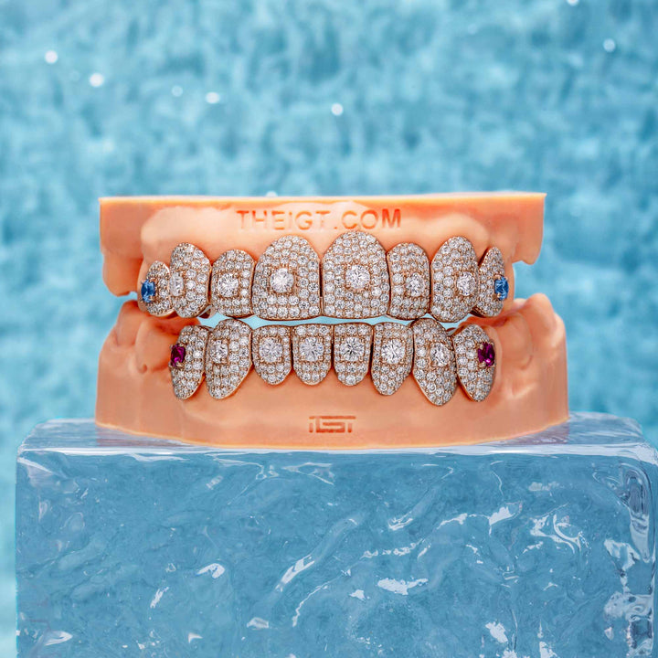 16 Pointer Stone On Center Moissanite Diamond Grillz