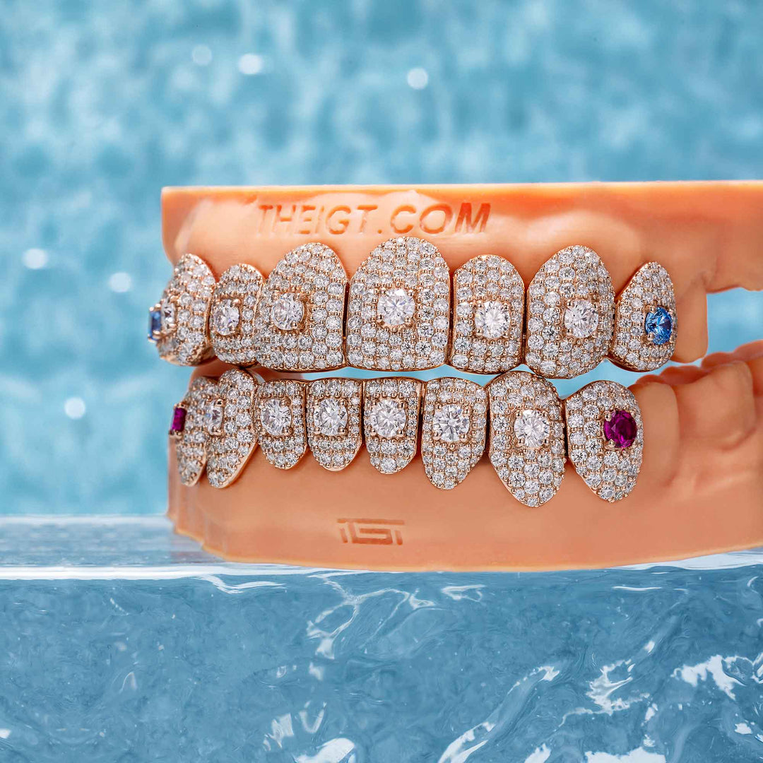 16 Pointer Stone On Center Moissanite Diamond Grillz