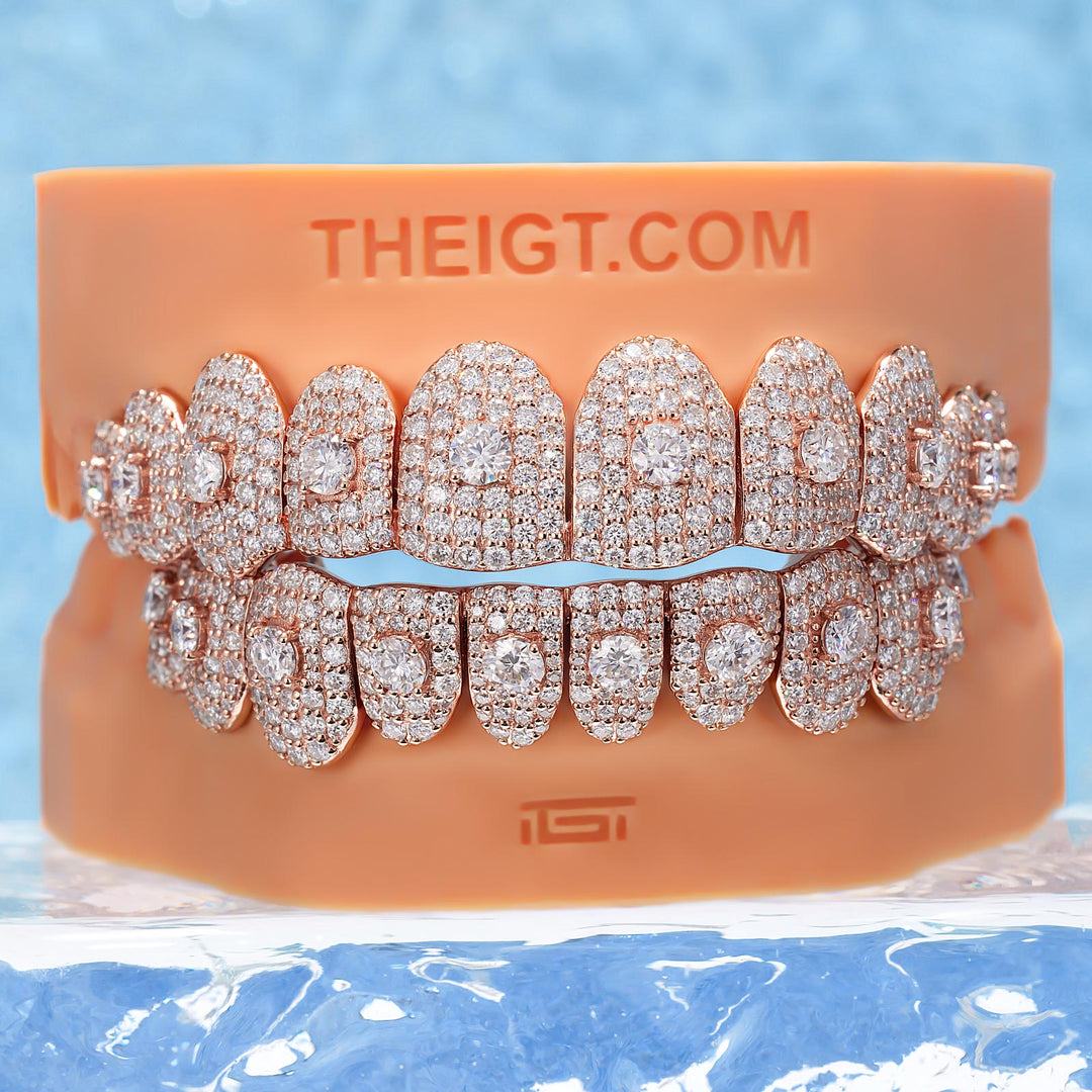16 Pointer Stone On Center Moissanite Diamond Grillz