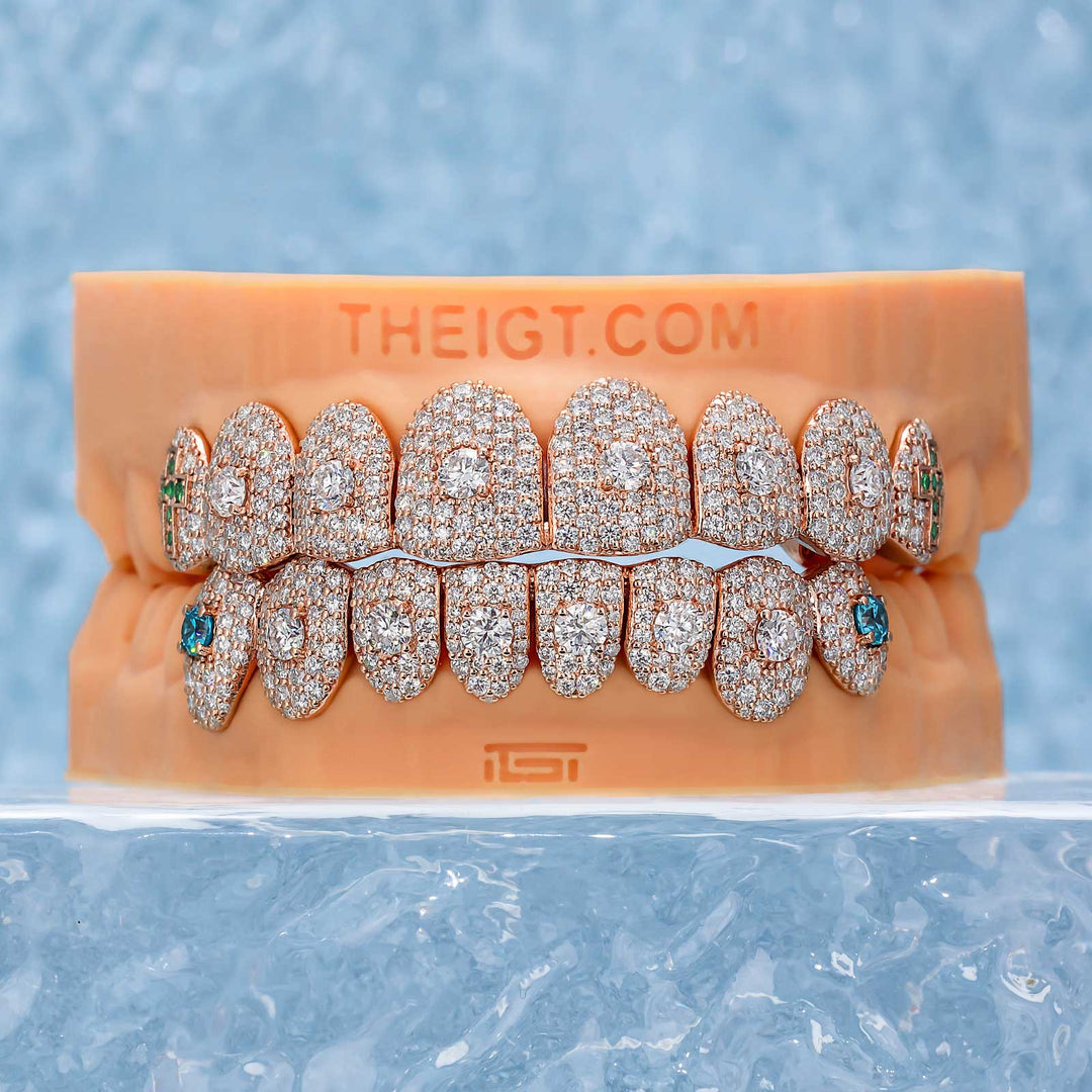 16 Pointer Stone On Center Moissanite Diamond Grillz