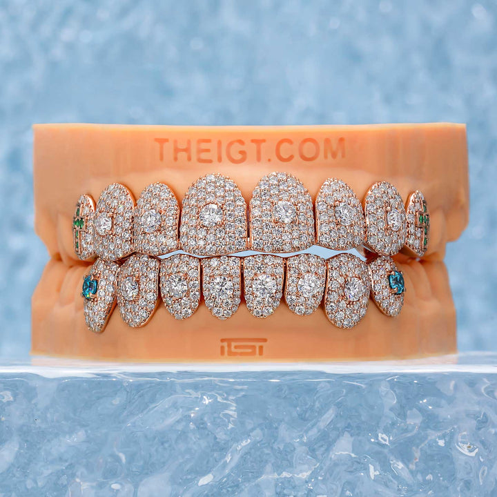 16 Pointer Stone On Center Moissanite Diamond Grillz