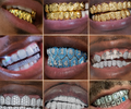 Brass Grillz Set