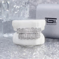 Custom Fully Iced Baguette & Emerald Cut Grillz