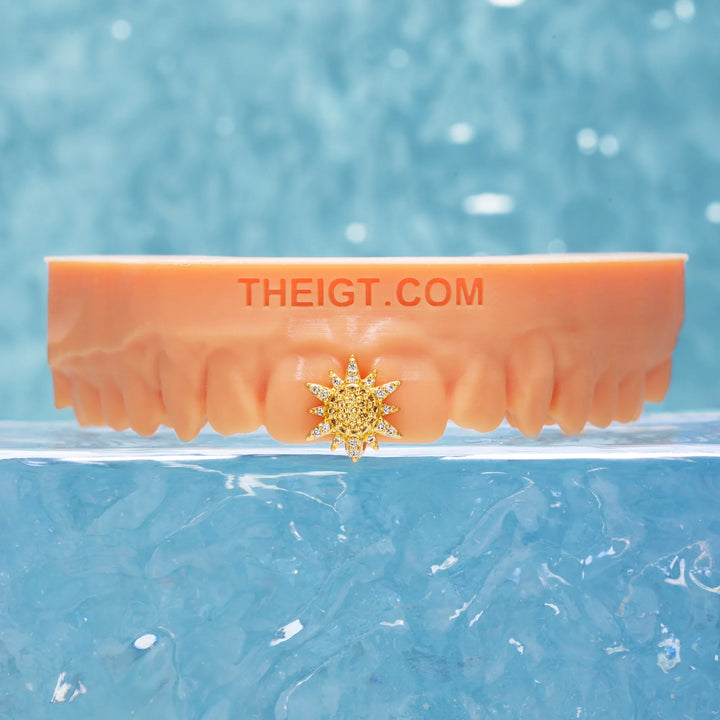 Single Sunshine Grillz