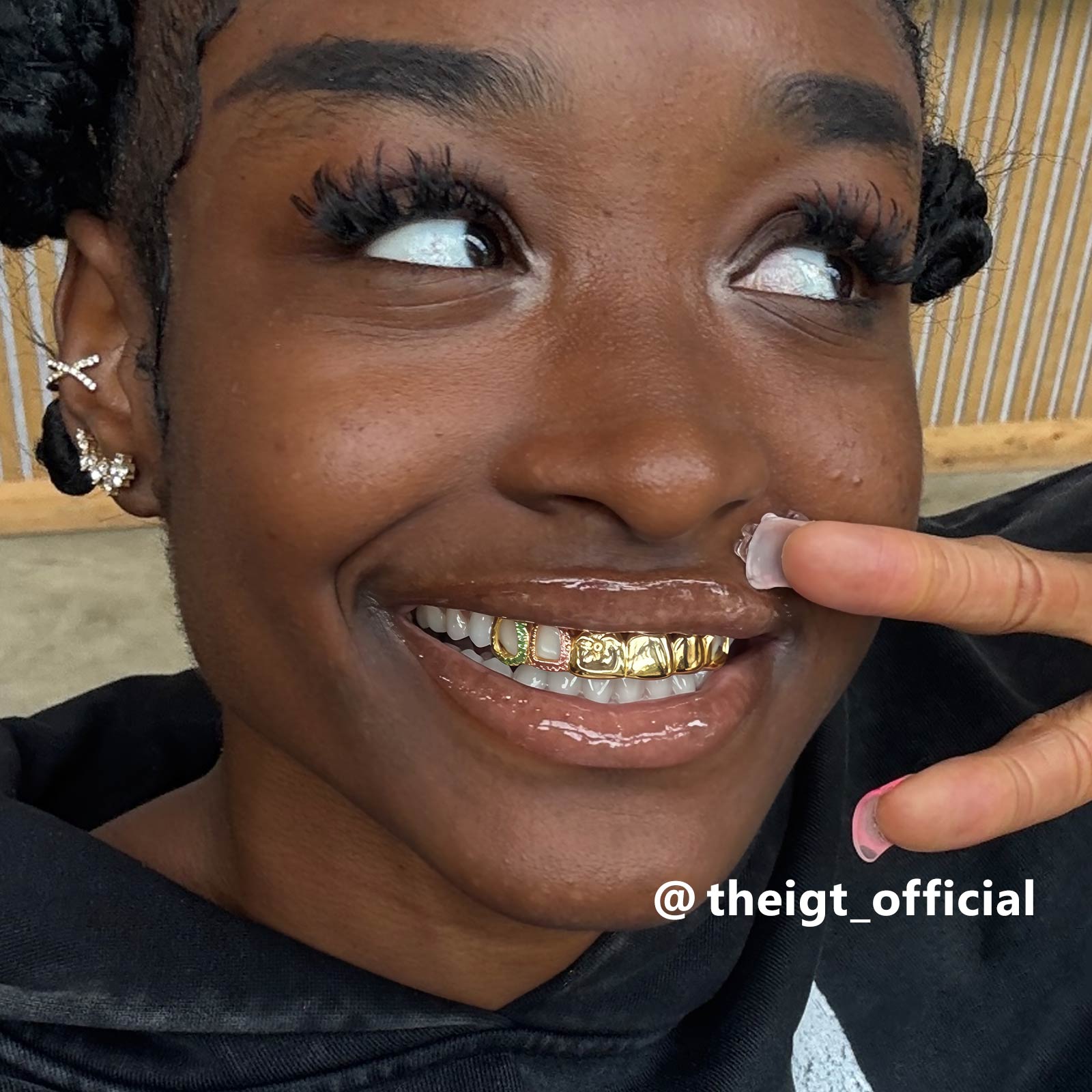 Top 6 Open Face Flower Grillz – ICEGIANT