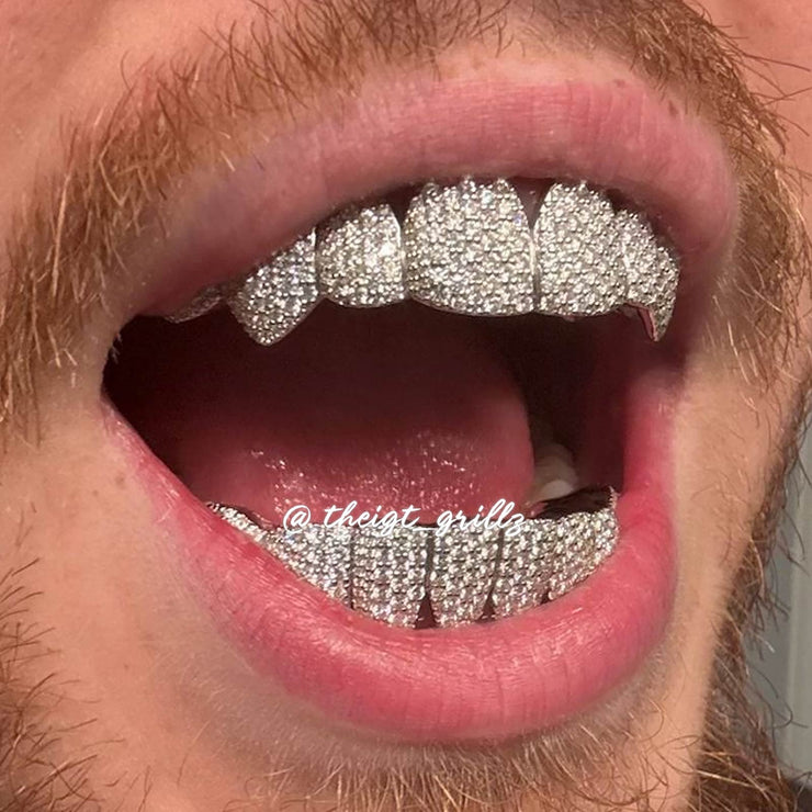 Custom Fully Iced Honeycomb Rimless Setting Grillz