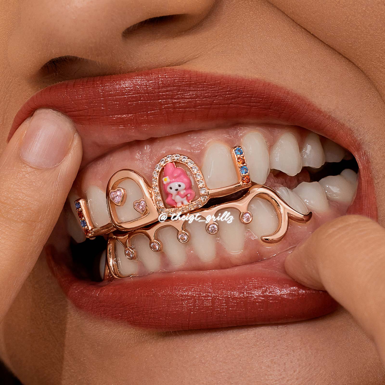 Pink Bunny Custom Grillz