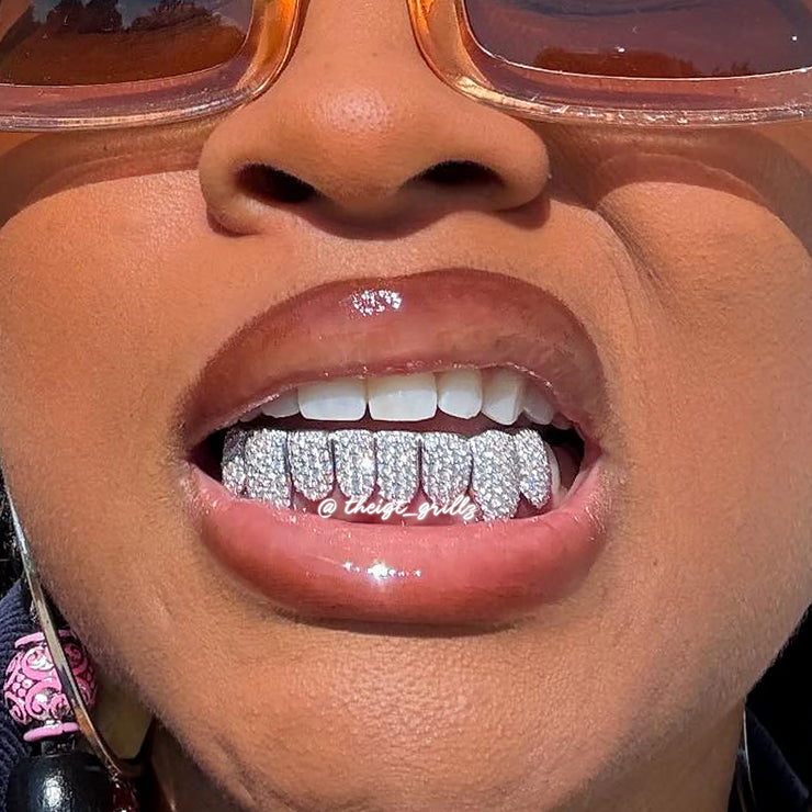 Custom Fully Iced Honeycomb Rimless Setting Grillz