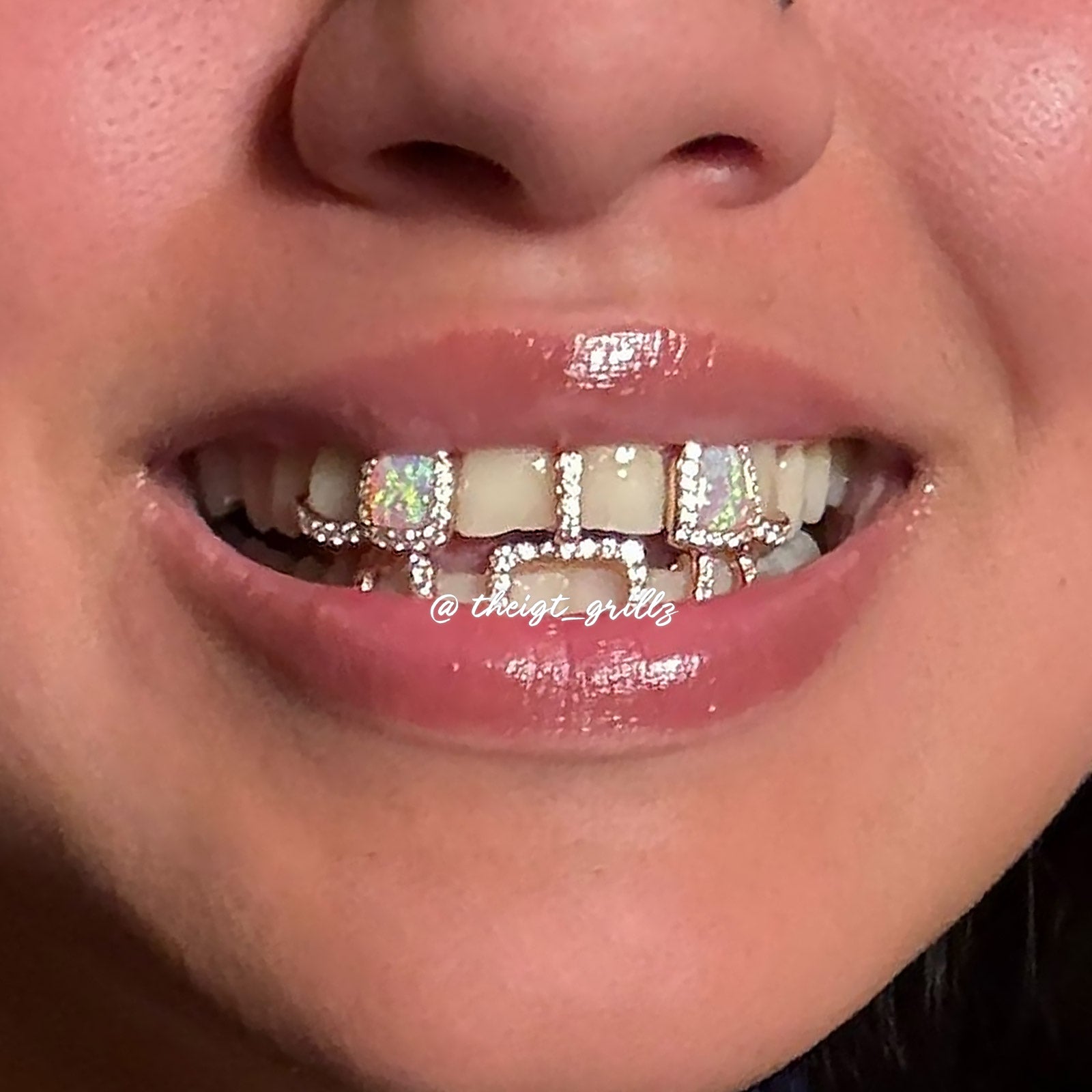 Top Opal & Bunny Tail Bar Grillz | Custom Gold Plated & Moissanite