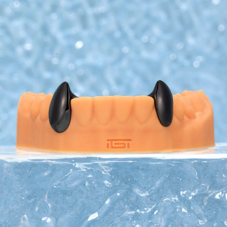 Custom Gold Fang Grillz